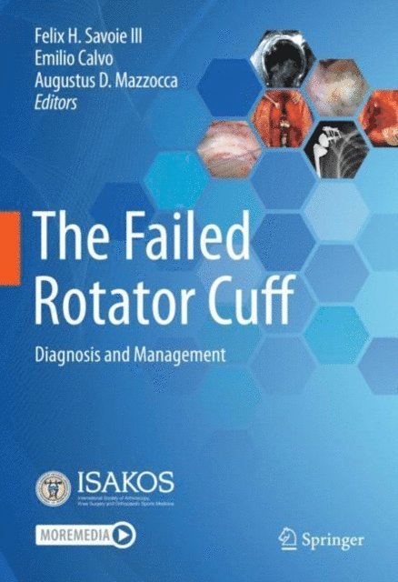 Augustus D. Mazzocca, Emilio Calvo, Felix H. Savoie III - Failed Rotator Cuff, E-bok
