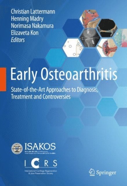 Elizaveta Kon, Norimasa Nakamura, Henning Madry, Christian Lattermann - Early Osteoarthritis, E-bok