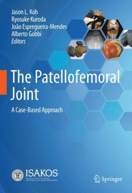 Alberto Gobbi, Joao Espregueira-Mendes, Ryosuke Kuroda, Jason L. Koh - Patellofemoral Joint, E-bok