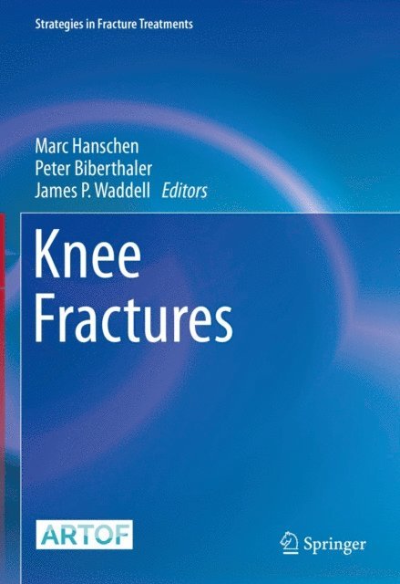 James P. Waddell, Peter Biberthaler, Marc Hanschen - Knee Fractures, E-bok