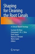 Shaping for Cleaning the Root Canals