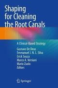 Shaping for Cleaning the Root Canals
