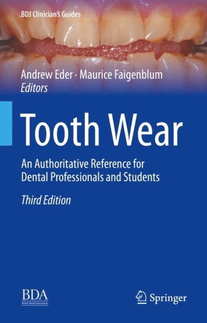 Maurice Faigenblum, Andrew Eder - Tooth Wear, E-bok
