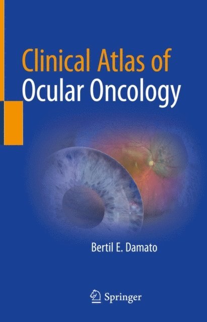 Bertil E. Damato - Clinical Atlas of Ocular Oncology, E-bok