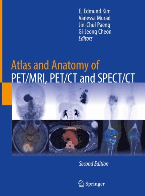 Gi-Jeong Cheon, Jin-Chul Paeng, Vanessa Murad, E. Edmund Kim - Atlas and Anatomy of PET/MRI, PET/CT and SPECT/CT, E-bok