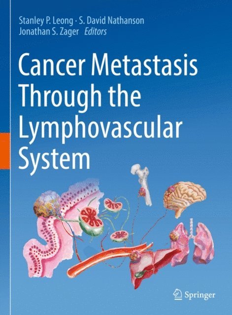 Jonathan S. Zager, S. David Nathanson, Stanley P. Leong - Cancer Metastasis Through the Lymphovascular System, E-bok
