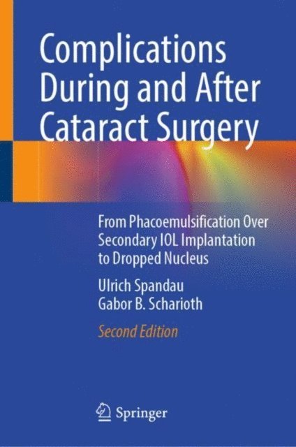 Gabor B. Scharioth, Ulrich Spandau - Complications During and After Cataract Surgery, E-bok