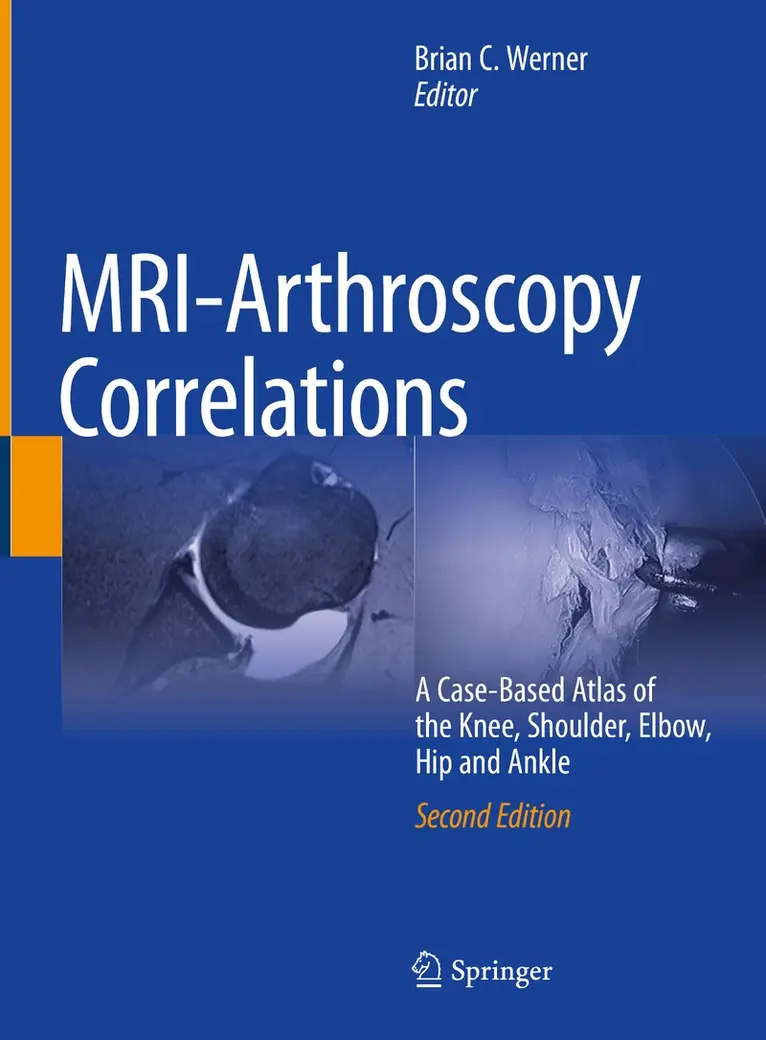 Brian C. Werner - MRI-Arthroscopy Correlations, Inbunden. Tillgänglighet: Lägg i varukorg