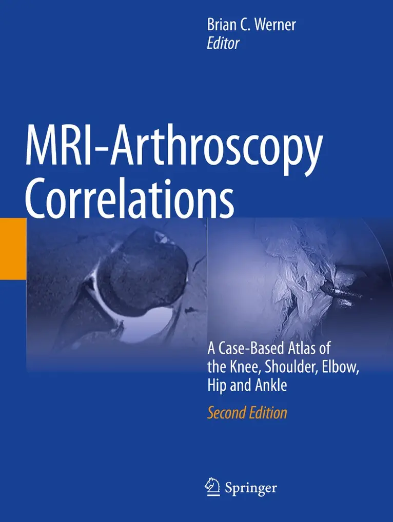 Brian C. Werner - MRI-Arthroscopy Correlations, Häftad. Tillgänglighet: Lägg i varukorg