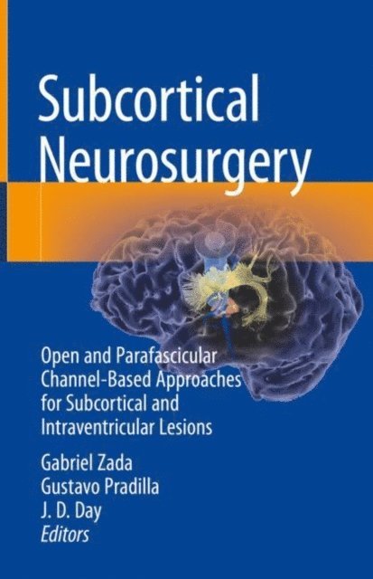 J. D. Day, Gustavo Pradilla, Gabriel Zada - Subcortical Neurosurgery, E-bok
