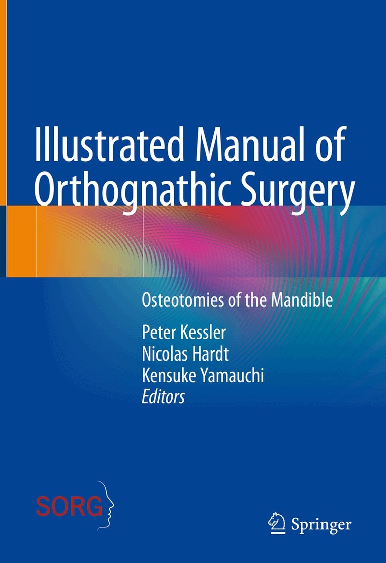 Peter Kessler, Nicolas Hardt, Kensuke Yamauchi - Illustrated Manual of Orthognathic Surgery, Inbunden. Tillgänglighet: Lägg i varukorg