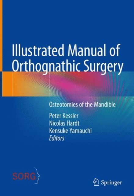 Kensuke Yamauchi, Nicolas Hardt, Peter Kessler - Illustrated Manual of Orthognathic Surgery, E-bok. Tillgänglighet: Lägg i varukorg