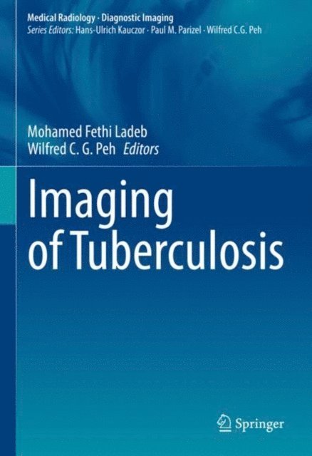 Wilfred C. G. Peh, Mohamed Fethi Ladeb - Imaging of Tuberculosis, E-bok