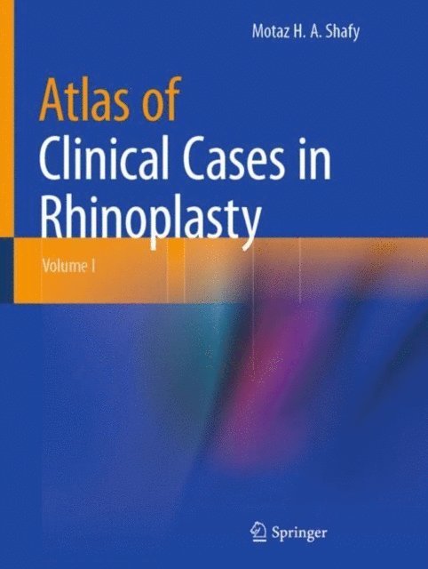 Motaz H. A. Shafy - Atlas of Clinical Cases in Rhinoplasty, E-bok. Tillgänglighet: Lägg i varukorg