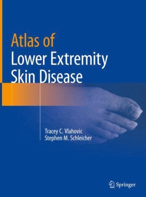Stephen M. Schleicher, Tracey C. Vlahovic - Atlas of Lower Extremity Skin Disease, E-bok. Tillgänglighet: Lägg i varukorg