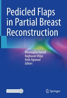 Pedicled Flaps in Partial Breast Reconstruction av Moustapha Hamdi, Raghavan Vidya, Amit Agrawal