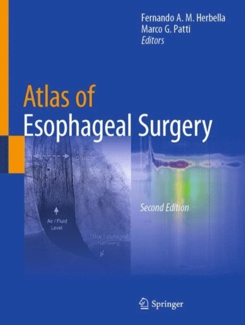 Marco G. Patti, Fernando A. M. Herbella - Atlas of Esophageal Surgery, E-bok