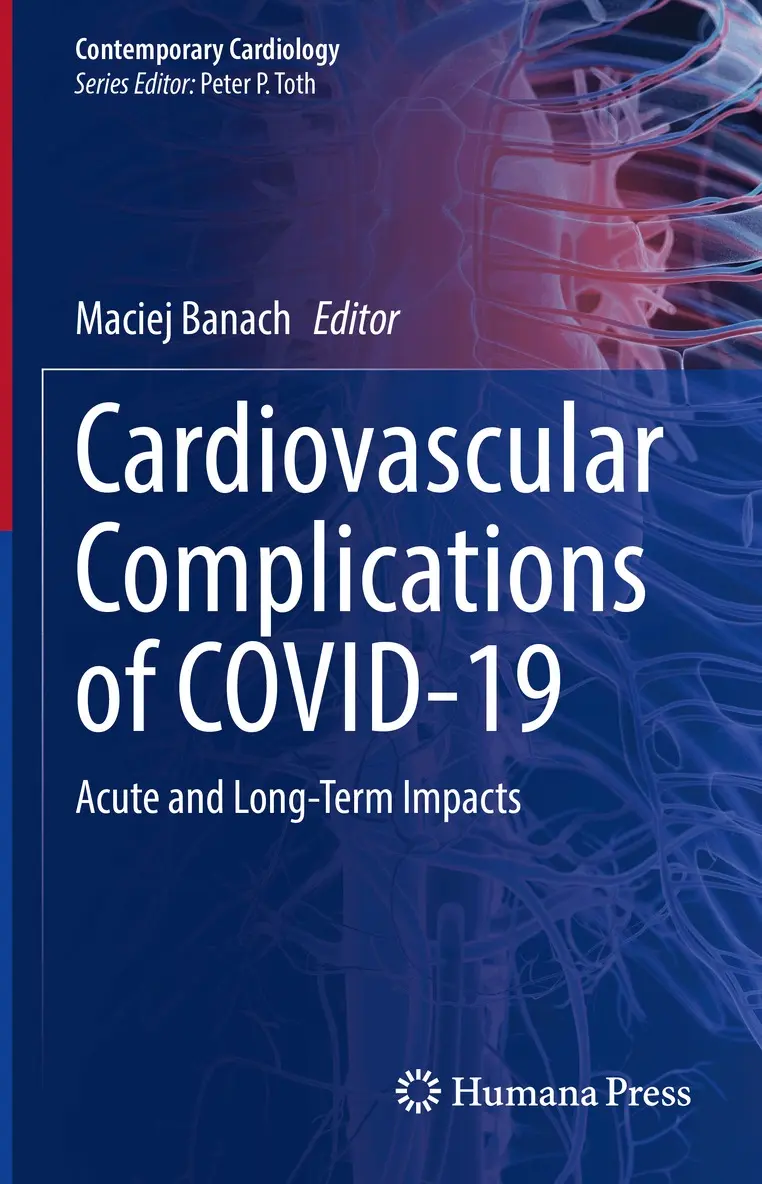 Maciej Banach - Cardiovascular Complications of COVID-19, Inbunden. Tillgänglighet: Lägg i varukorg