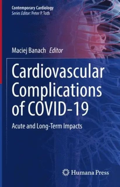 Maciej Banach - Cardiovascular Complications of COVID-19, E-bok. Tillgänglighet: Lägg i varukorg