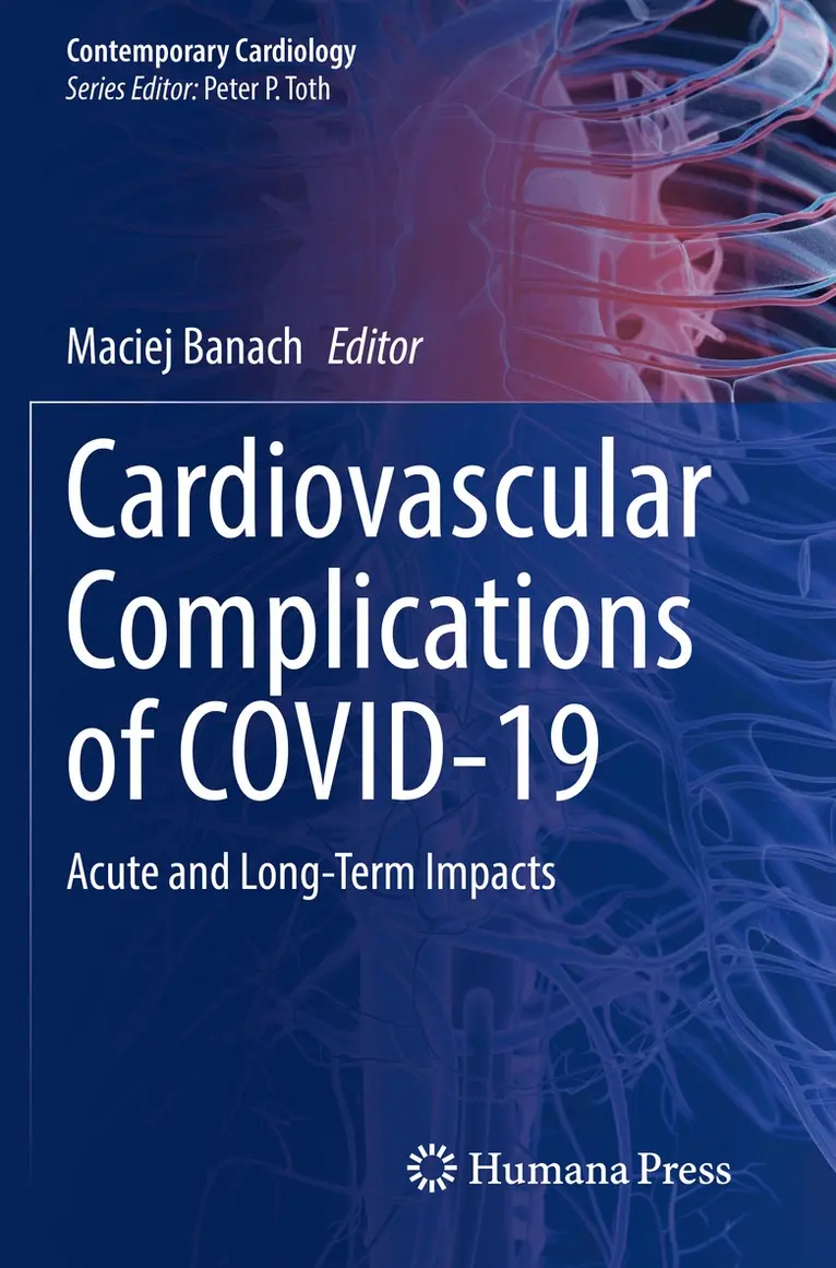 Maciej Banach - Cardiovascular Complications of COVID-19, Häftad. Tillgänglighet: Lägg i varukorg