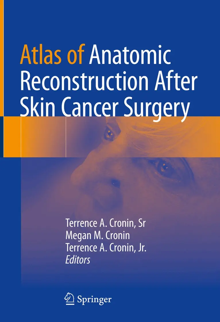 Terrence A. Cronin, Sr, Megan M. Cronin, Terrence A. Cronin, Jr. - Atlas of Anatomic Reconstruction After Skin Cancer Surgery, Inbunden. Tillgänglighet: Lägg i varukorg