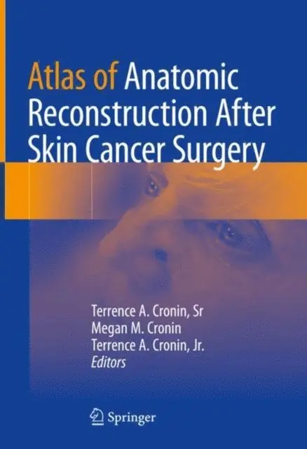 Terrence A. Cronin, Jr., Megan M. Cronin, Terrence A. Cronin, Sr - Atlas of Anatomic Reconstruction After Skin Cancer Surgery, E-bok. Tillgänglighet: Lägg i varukorg