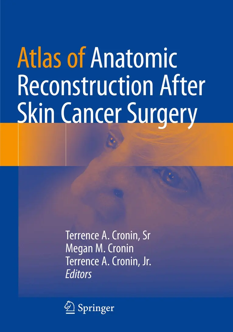 Terrence A. Cronin, Sr, Megan M. Cronin, Terrence A. Cronin, Jr. - Atlas of Anatomic Reconstruction After Skin Cancer Surgery, Häftad. Tillgänglighet: Lägg i varukorg