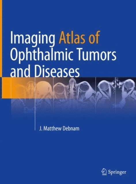 J. Matthew Debnam - Imaging Atlas of Ophthalmic Tumors and Diseases, E-bok