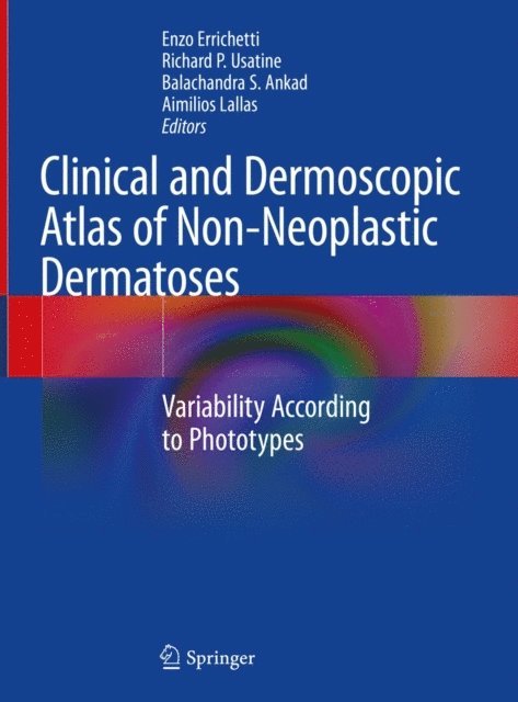 Aimilios Lallas, Balachandra S. Ankad, Richard P. Usatine, Enzo Errichetti - Clinical and Dermoscopic Atlas of Non-Neoplastic Dermatoses, E-bok