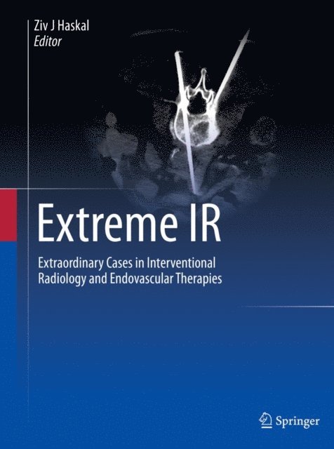 Ziv J Haskal - Extreme IR, E-bok. Tillgänglighet: Lägg i varukorg