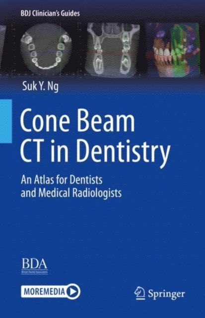 Suk Y. Ng - Cone Beam CT in Dentistry, E-bok
