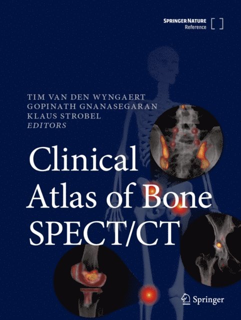 Klaus Strobel, Gopinath Gnanasegaran, Tim Van den Wyngaert - Clinical Atlas of Bone SPECT/CT, E-bok