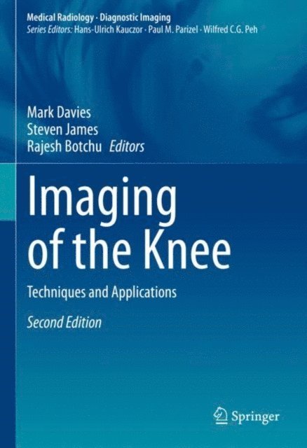 Rajesh Botchu, Steven James, Mark Davies - Imaging of the Knee, E-bok