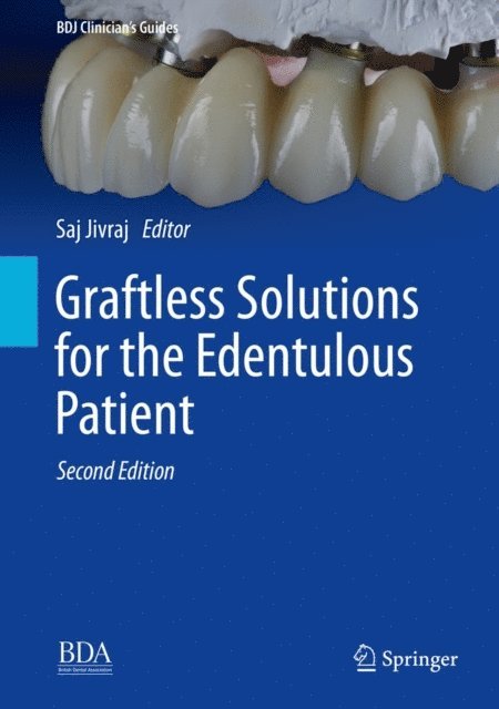 Saj Jivraj - Graftless Solutions for the Edentulous Patient, E-bok