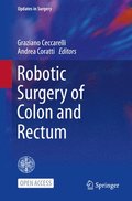 Robotic Surgery of Colon and Rectum