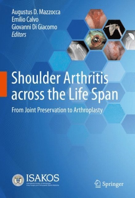 Giovanni Di Giacomo, Emilio Calvo, Augustus D. Mazzocca - Shoulder Arthritis across the Life Span, E-bok