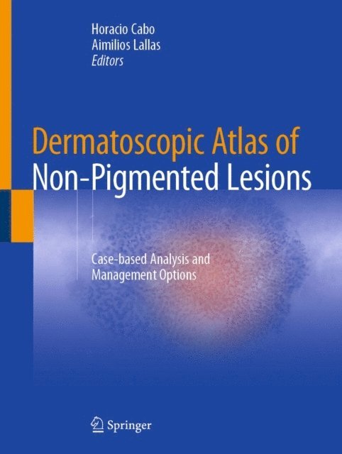 Aimilios Lallas, Horacio Cabo - Dermatoscopic Atlas of Non-Pigmented Lesions, E-bok