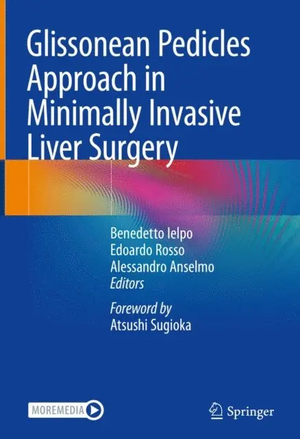 Alessandro Anselmo, Edoardo Rosso, Benedetto Ielpo - Glissonean Pedicles Approach in Minimally Invasive Liver Surgery, E-bok. Tillgänglighet: Lägg i varukorg