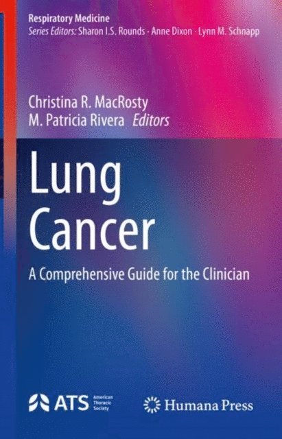 M. Patricia Rivera, Christina R. MacRosty - Lung Cancer, E-bok