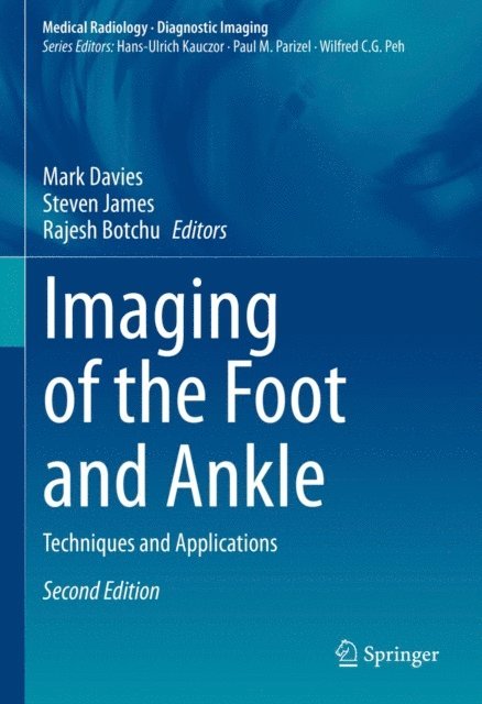 Rajesh Botchu, Steven James, Mark Davies - Imaging of the Foot and Ankle, E-bok