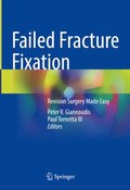 Failed Fracture Fixation