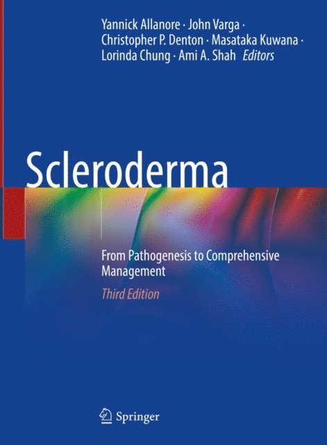 Ami A. Shah, Lorinda Chung, Masataka Kuwana, Christopher P. Denton, John Varga, Yannick Allanore - Scleroderma, E-bok