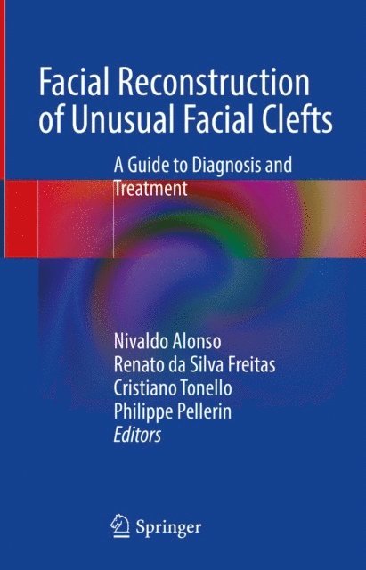 Philippe Pellerin, Cristiano Tonello, Renato da Silva Freitas, Nivaldo Alonso - Facial Reconstruction of Unusual Facial Clefts, E-bok
