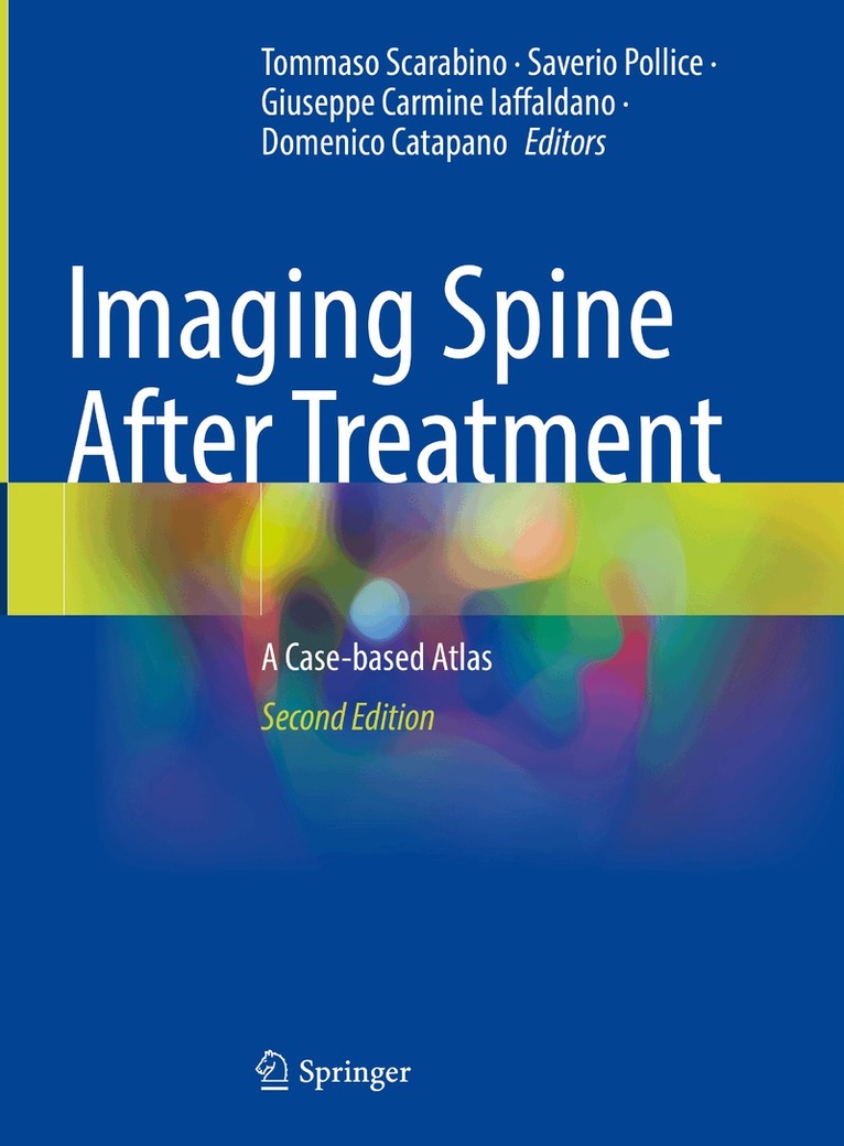 Tommaso Scarabino, Saverio Pollice, Giuseppe Carmine Iaffaldano, Domenico Catapano - Imaging Spine After Treatment, Inbunden