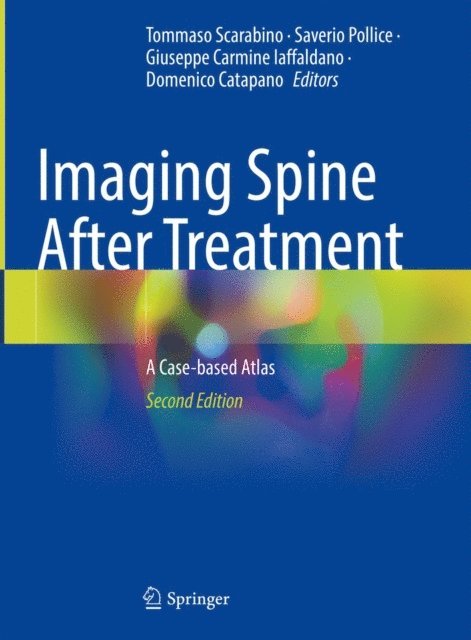 Domenico Catapano, Giuseppe Carmine Iaffaldano, Saverio Pollice, Tommaso Scarabino - Imaging Spine After Treatment, E-bok