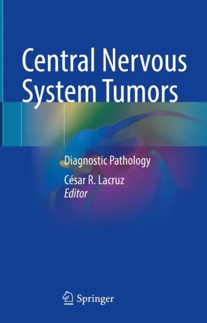 Cesar R. Lacruz - Central Nervous System Tumors, E-bok