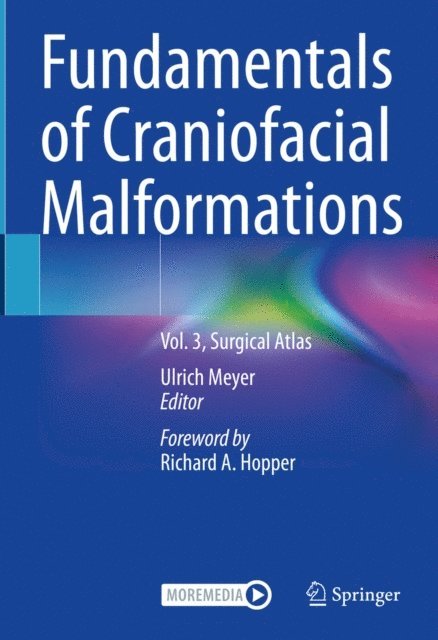 Ulrich Meyer - Fundamentals of Craniofacial Malformations, E-bok