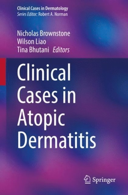 Tina Bhutani, Wilson Liao, Nicholas Brownstone - Clinical Cases in Atopic Dermatitis, E-bok