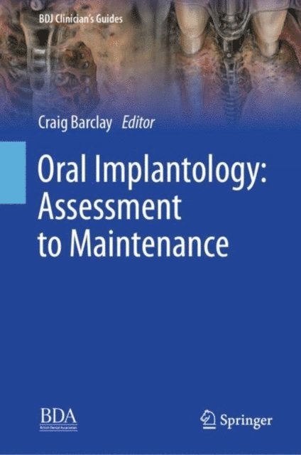 Craig Barclay - Oral Implantology: Assessment to Maintenance, E-bok