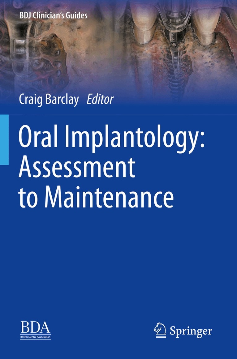 Craig Barclay - Oral Implantology: Assessment to Maintenance, Häftad. Tillgänglighet: Lägg i varukorg